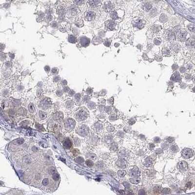 Immunohistochemistry-Paraffin: C16orf89 Antibody [NBP1-93470]