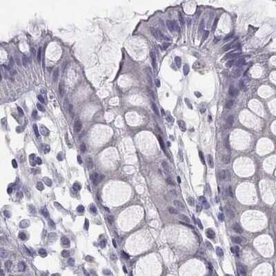 Immunohistochemistry-Paraffin: C16orf89 Antibody [NBP1-93470]
