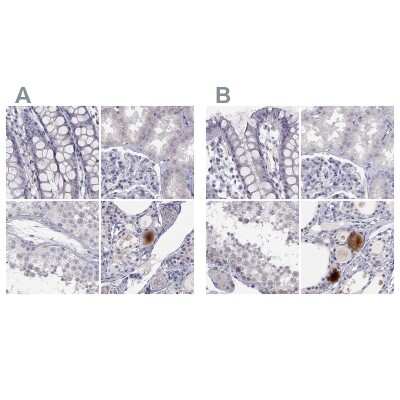 Immunohistochemistry-Paraffin: C16orf89 Antibody [NBP2-68592]
