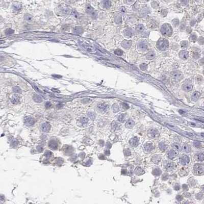 Immunohistochemistry-Paraffin: C16orf89 Antibody [NBP2-68592]