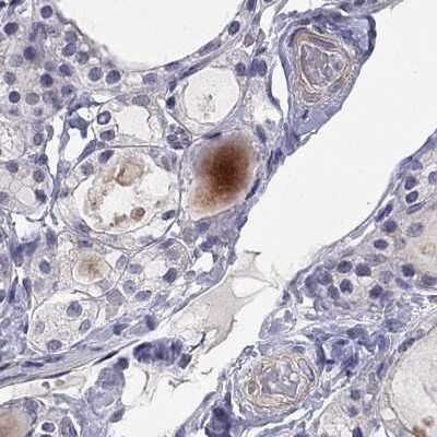 Immunohistochemistry-Paraffin: C16orf89 Antibody [NBP2-68592]