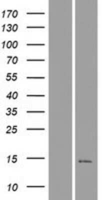 Western Blot: C16orf92 Overexpression Lysate [NBP2-09365]