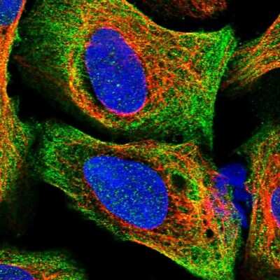 Immunocytochemistry/ Immunofluorescence: CCDC189 Antibody [NBP2-30950]