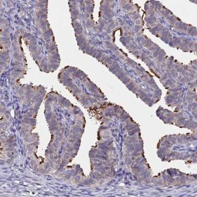 Immunohistochemistry-Paraffin: CCDC189 Antibody [NBP2-30829]