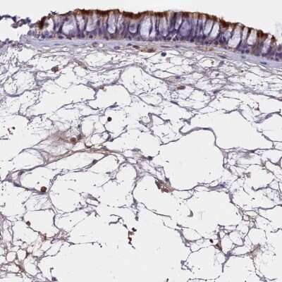 Immunohistochemistry-Paraffin: CCDC189 Antibody [NBP2-30950]