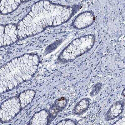 Immunohistochemistry-Paraffin: C16orf95 Antibody [NBP1-91131]