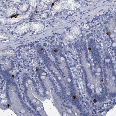 Immunohistochemistry-Paraffin: C16orf95 Antibody [NBP1-91131]