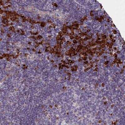 Immunohistochemistry: C16orf96 Antibody [NBP1-91124]