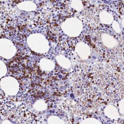 Immunohistochemistry-Paraffin: C16orf96 Antibody [NBP1-91126]