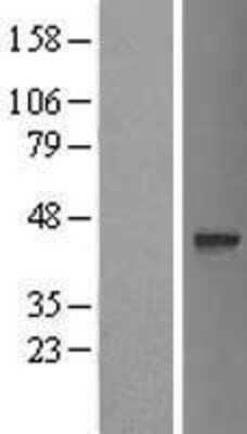 Western Blot: OGFOD3 Overexpression Lysate [NBL1-10758]