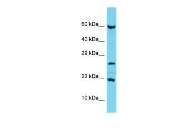 Western Blot: C17orf102 Antibody [NBP3-10759]