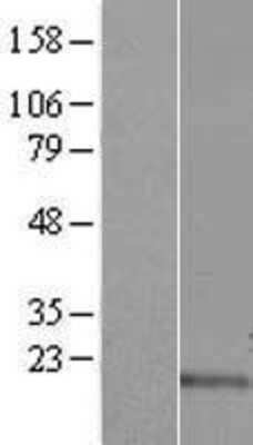 Western Blot: C17orf102 Overexpression Lysate [NBP2-04503]