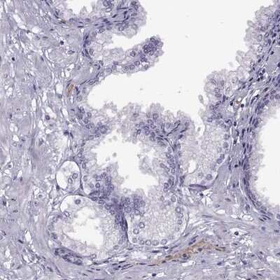 Immunohistochemistry-Paraffin: Meiosis 1 Associated Protein Antibody [NBP1-83495]