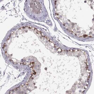 Immunohistochemistry-Paraffin: Meiosis 1 Associated Protein Antibody [NBP1-83495]