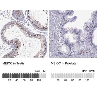 Immunohistochemistry-Paraffin: Meiosis 1 Associated Protein Antibody [NBP1-83495]