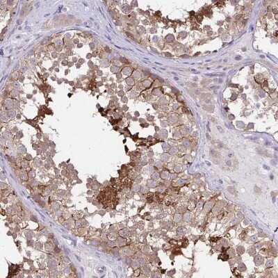 Immunohistochemistry-Paraffin: CFAP97D1 Antibody [NBP2-38687]