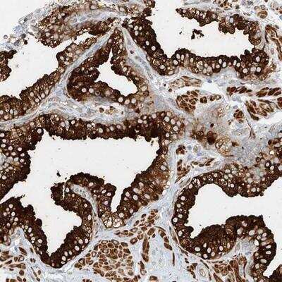 Immunohistochemistry: LYRM9 Antibody [NBP1-93689]