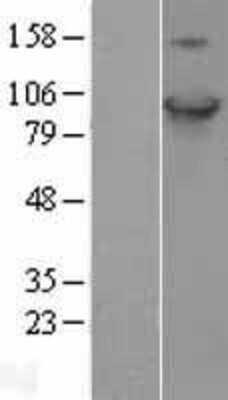 Western Blot: HID1 Overexpression Lysate [NBL1-08231]