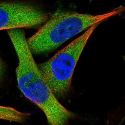 Immunocytochemistry/ Immunofluorescence: GID4 Antibody [NBP1-91717]