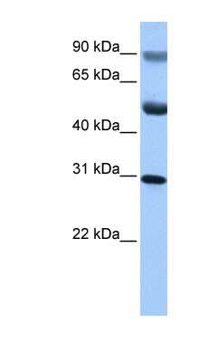 Western Blot: GID4 Antibody [NBP1-53184]