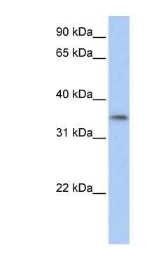 Western Blot: GID4 Antibody [NBP1-53185]