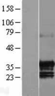 Western Blot: GID4 Overexpression Lysate [NBL1-08233]