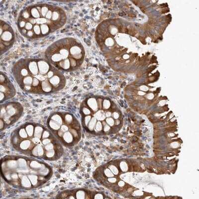 Immunohistochemistry-Paraffin: SPATA32 Antibody [NBP1-93913]