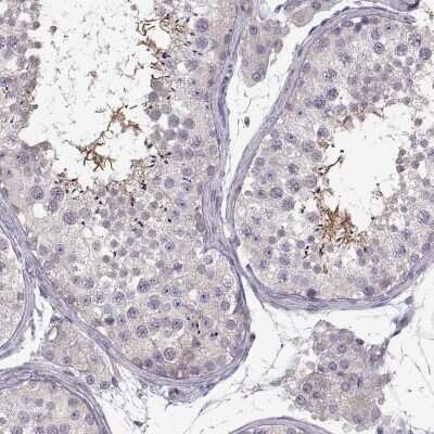 Immunohistochemistry-Paraffin: SPATA32 Antibody [NBP1-93913]