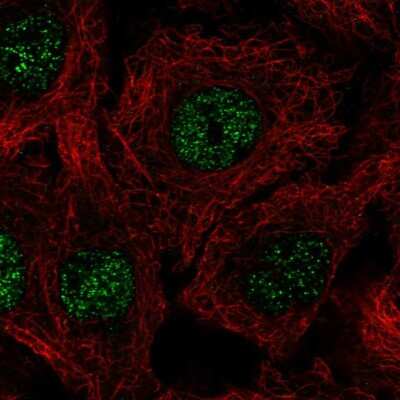 Immunocytochemistry/ Immunofluorescence: C17orf50 Antibody [NBP2-55586]