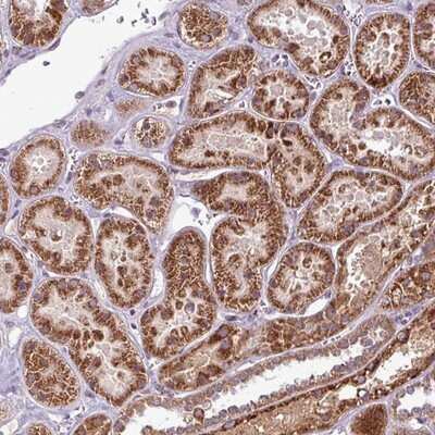 Immunohistochemistry-Paraffin: LINC02693 Antibody [NBP2-14760]