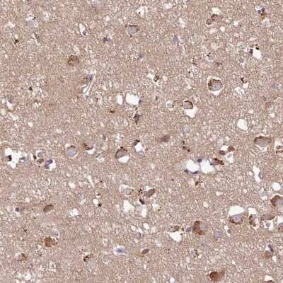 Immunohistochemistry-Paraffin: LINC02693 Antibody [NBP2-14760]
