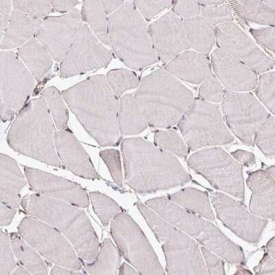 Immunohistochemistry-Paraffin: LINC02693 Antibody [NBP2-14760]