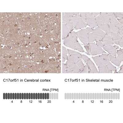 Immunohistochemistry-Paraffin: LINC02693 Antibody [NBP2-14760]