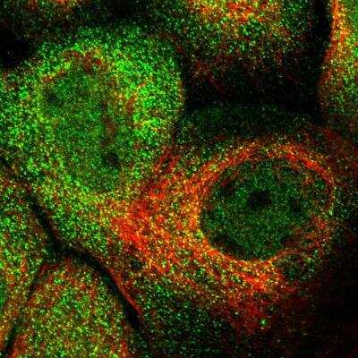 Immunocytochemistry/ Immunofluorescence: HROB Antibody [NBP1-93493]