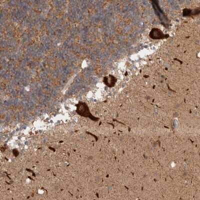 Immunohistochemistry-Paraffin: HROB Antibody [NBP1-93493]