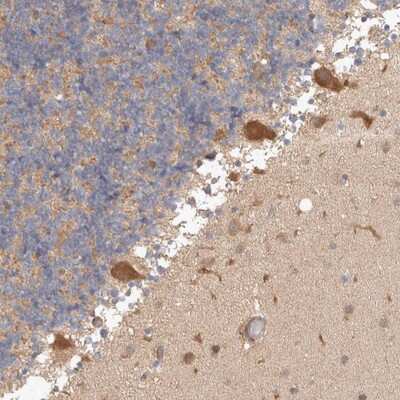 Immunohistochemistry-Paraffin: HROB Antibody [NBP1-93495]