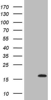 Western Blot: C17orf58 Antibody (OTI6E9) [NBP2-46593]