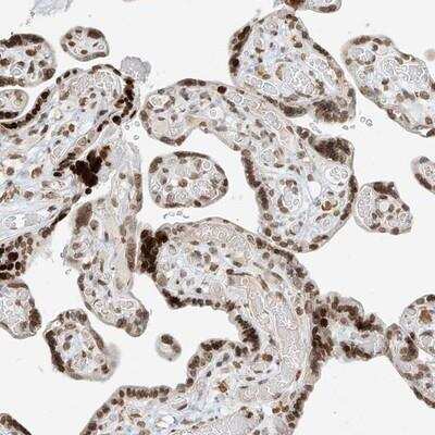 Immunohistochemistry-Paraffin: C17orf58 Antibody [NBP1-86418]