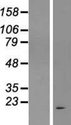 Western Blot: C17orf58 Overexpression Lysate [NBL1-08238]