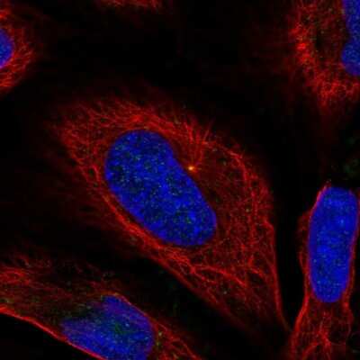 Immunocytochemistry/ Immunofluorescence: BORC6 Antibody [NBP2-56321]