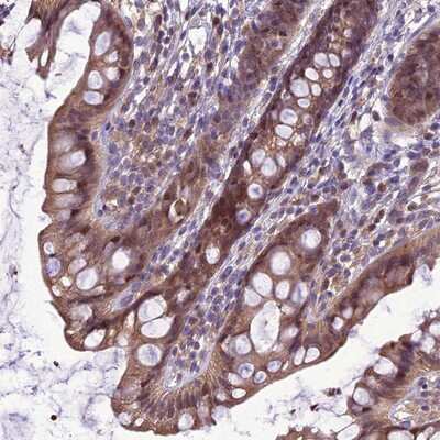 Immunohistochemistry-Paraffin: BORC6 Antibody [NBP1-93992]