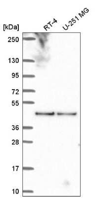 Western Blot: BORC6 Antibody [NBP2-56321]