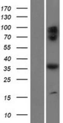 Western Blot: BORC6 Overexpression Lysate [NBP2-10228]