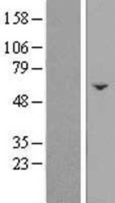 Western Blot: FAM222B Overexpression Lysate [NBL1-08241]