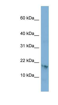 Western Blot: C17orf64 Antibody [NBP1-70442]