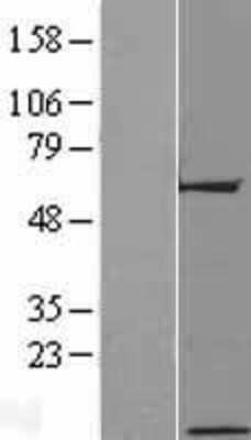 Western Blot: C17orf64 Overexpression Lysate [NBP2-04897]