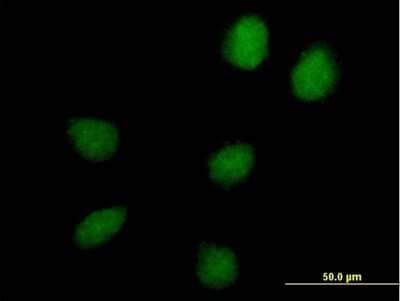 Immunocytochemistry/ Immunofluorescence: HEATR9 Antibody [H00256957-B01P]