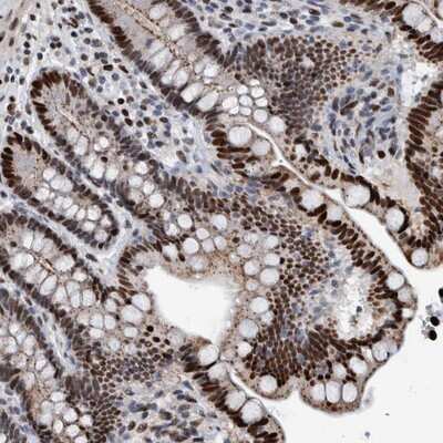 Immunohistochemistry-Paraffin: HEATR9 Antibody [NBP1-81985]