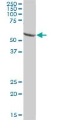 Western Blot: HEATR9 Antibody [H00256957-B01P]