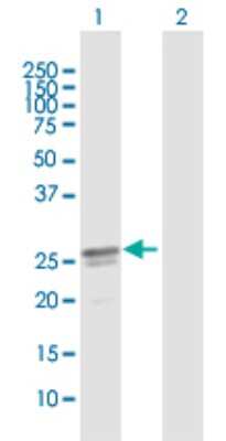 Western Blot: HEATR9 Antibody [H00256957-B01P]